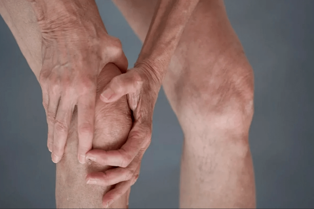 sąnarių skausmas gali būti artrozės ar artrito priežastis