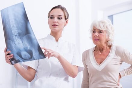 Rentgeno tyrimas yra informatyvus būdas diagnozuoti stuburo osteochondrozę