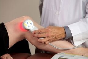 Sąnarių artrozės lazerio terapijos procedūra