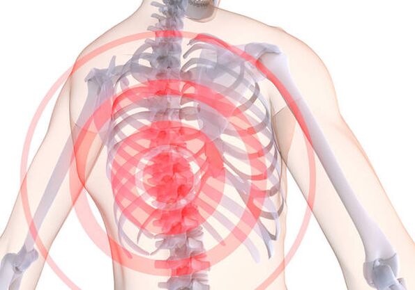 Krūtinės ląstos osteochondrozę lydi dorsago - ūmus skausmas, kuris varžo raumenis