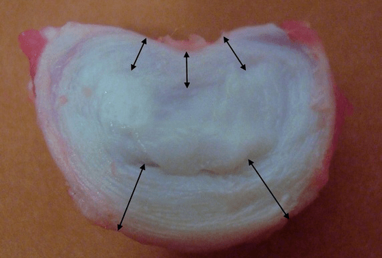 kaip atrodo tarpslankstelinis diskas