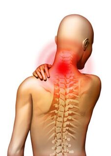 Skausmas yra pagrindinis gimdos kaklelio osteochondrozės simptomas