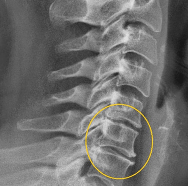 Diagnostinis paveikslėlis